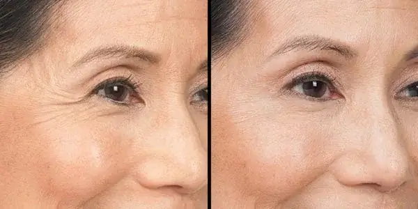 Before and After Images Customer 1