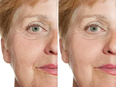 Barbara Before and After