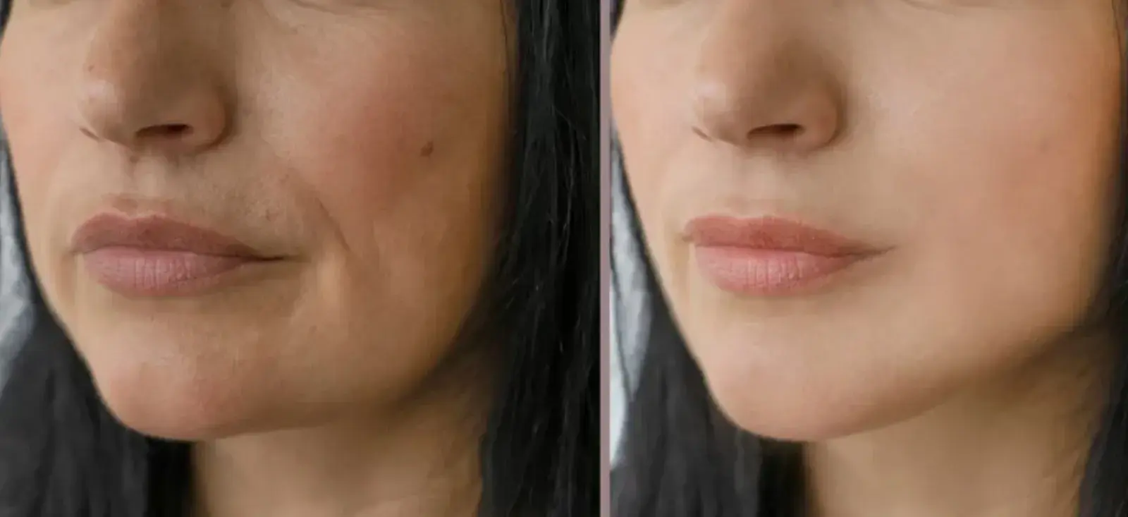 Daisy Before and After