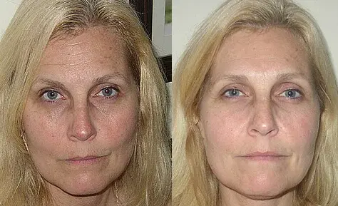 Maria Before and After