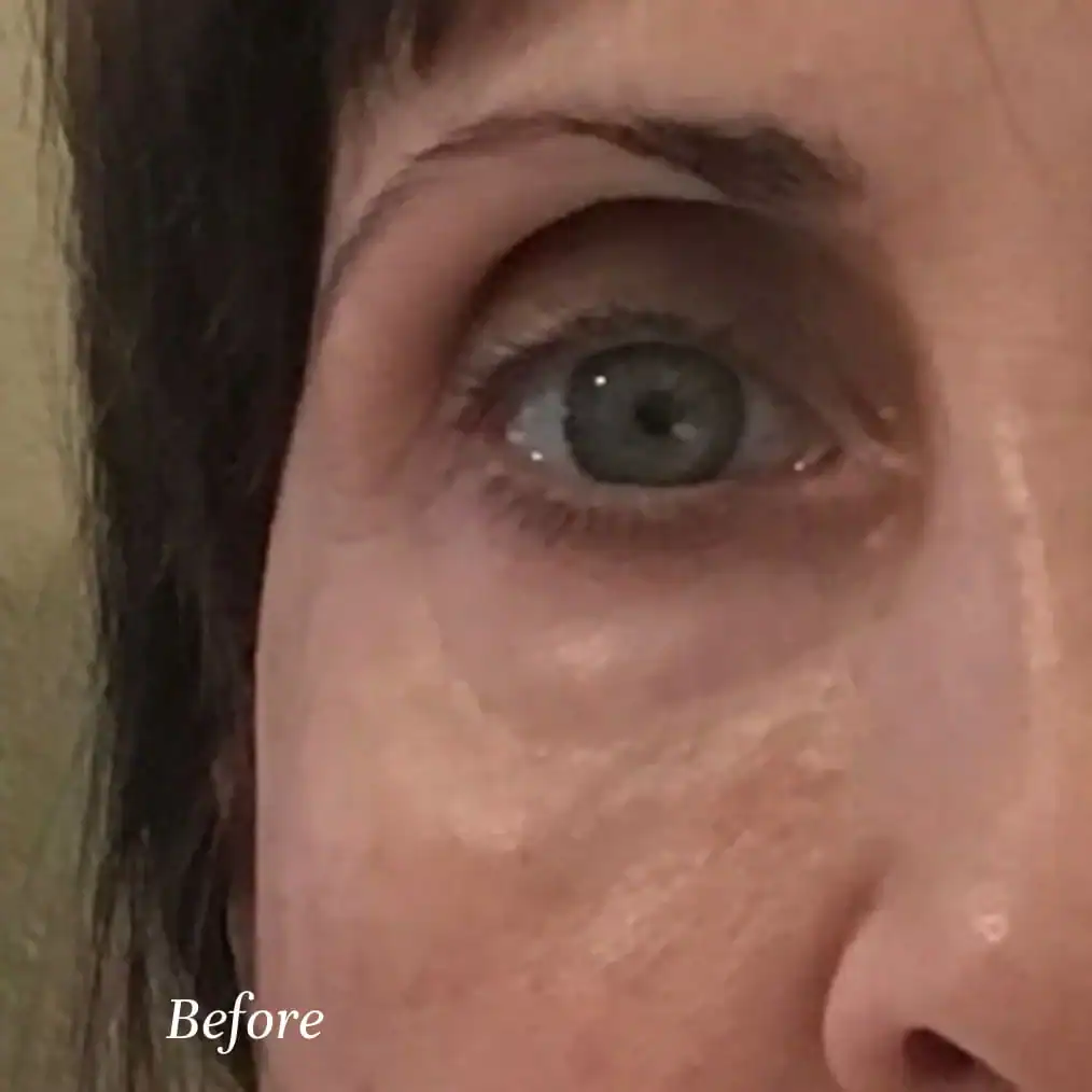 Before-Image-Customer