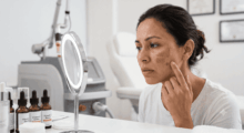 The Dark Spot Diagnosis: Why Your Vitamin C Drops Aren’t Clearing Your Hyperpigmentation (And the Laser That Will)